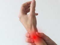 How is RSI treated under workers’ compensation?